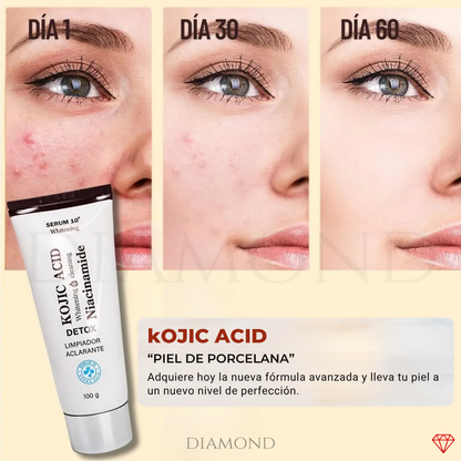 KOJIC ACID EXFOLIANTE UNIFICADOR "PIEL DE PORCELANA"